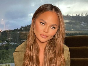 Chrissy Teigen Jalani Operasi Dahi karena Rambut Rontok Setelah Melahirkan