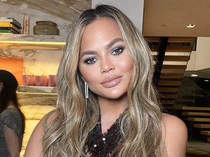 Luapan Kekesalan Model Chrissy Teigen Dituding Suntik Filler oleh Nakes