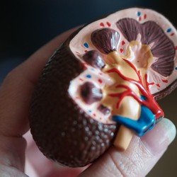 Dokter Ungkap Gejala Batu Ginjal yang Terlihat saat Buang Air Kecil
