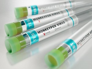 Pengakuan Orang-orang yang Terinfeksi Mpox, Ternyata Ini yang Dirasakan