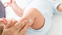 Kulit Ekstra Kering Sampai Gatal? Ini Cara Rawatnya Selain Ganti-Ganti Lotion