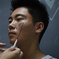 Korea Surga Operasi Plastik, Pasien Terbanyak dari Negara Ini