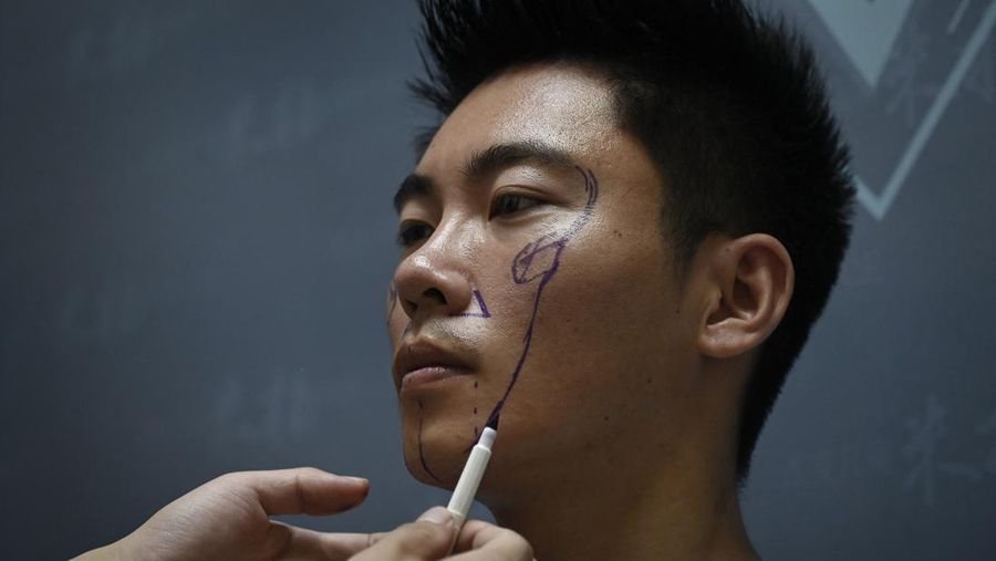 Ilustrasi Operasi Pelastik (Photo by WANG ZHAO/AFP via Getty Images)