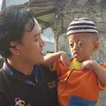 Anak Buruh Cuci Ini Tetap Semangat Meski Alami Sindrom Langka