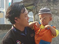 Anak Buruh Cuci Ini Tetap Semangat Meski Alami Sindrom Langka
