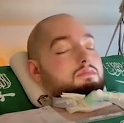 Kondisi Terkini Sleeping Prince Arab yang Koma Hampir 20 Tahun