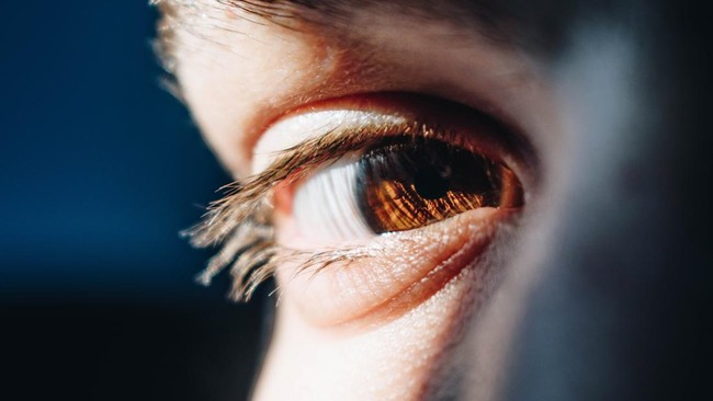 Penglihatan Kabur Saat Puasa Normal atau Tidak? Ini Jawaban Ahli