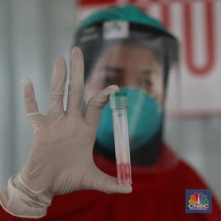Kasus RI Melonjak, Gejala Covid Varian Baru Muncul di Mata