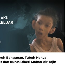 Derita Lissa Anak Buruh Bangunan, Terbaring Lemas dan Kurus