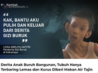 Derita Lissa Anak Buruh Bangunan, Terbaring Lemas dan Kurus