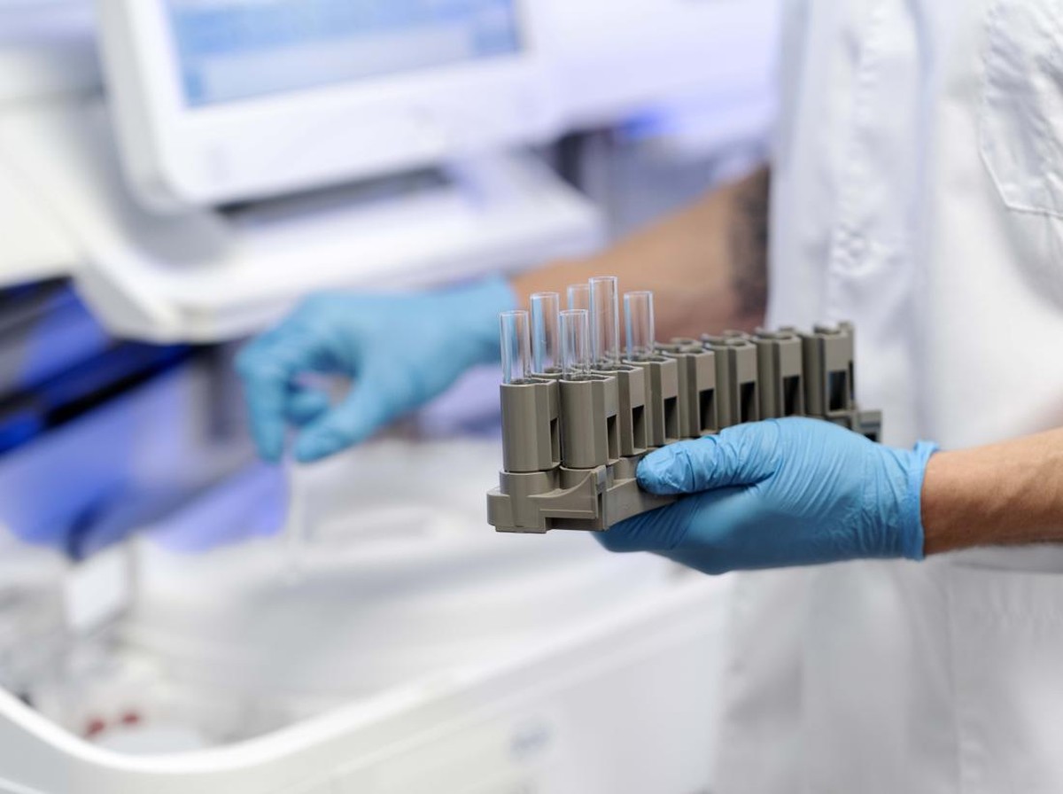 Startup Cofertility Tawarkan Pembekuan Sel Telur Gratis dengan Program Donor Unik