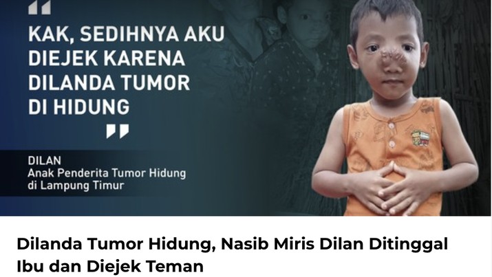 Penyakit tumor tidak mengenal usia, tua ataupun muda bisa saja mengalami tumor. Penyakit inilah yang juga dialami Dilan Satya Ardana (4) asal Lampung Timur. (Tangkapan Layar berbuatbaik.id)