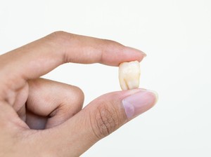 10 Arti Mimpi Gigi Copot Semua, Pertanda Baik atau Buruk?