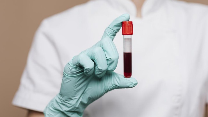 Ilustrasi hemofilia Nurse holding a blood test tube
