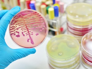 Menu MBG Picu Keracunan Massal di Grobogan Positif Mengandung E Coli