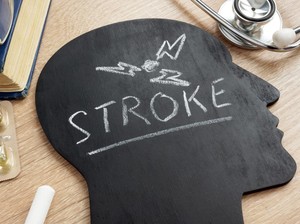 Studi Ungkap Penyebab Banyak Anak Muda yang Mulai Kena Stroke
