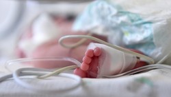 1 dari 4 Balita di RI Alami Anemia, Kenali Tanda-tandanya Sebelum Terlambat