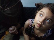 Secercah Sinar Hidup Untuk Mata Si Kecil Zahida Qalbi Nadifa