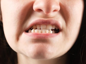 Viral Istilah Mewing di Medsos, Termasuk Operasi Plastik? Ini Penjelasannya