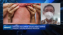 Awas! Kasus Meningkat 32 Kali Lipat, Indonesia KLB Campak