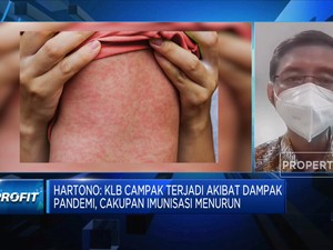 Awas! Kasus Meningkat 32 Kali Lipat, Indonesia KLB Campak