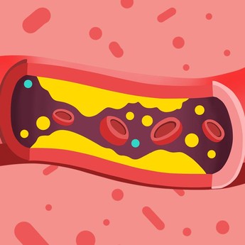 Tidak Perlu Obat, Buah-Buahan Ini Ampuh Turunkan Kolesterol