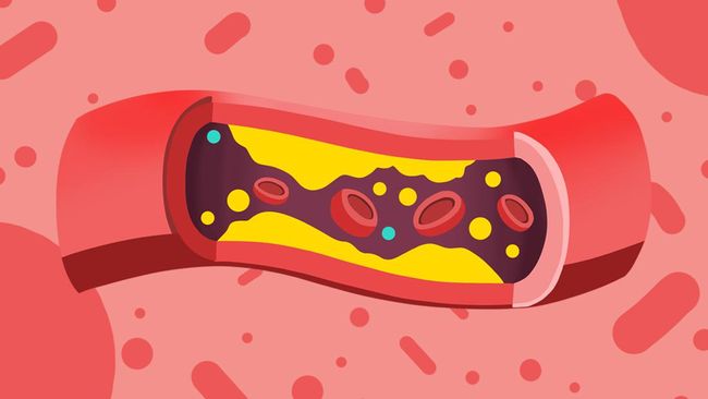 Waktu Sarapan Ideal Bagi Penderita Kolesterol Tinggi Menurut Ahli Gizi