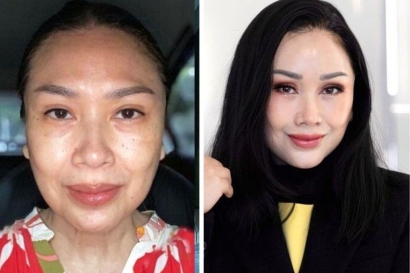 Penyanyi diva Indonesia Titi DJ baru-baru ini membagikan pengalamannya melakukan operasi anti aging atau anti penuaan di Gangnam, Korea Selatan pada 6 Januari lalu. (Tangkapan layar instagram @ti2dj) Penyanyi diva Indonesia Titi DJ baru-baru ini membagikan pengalamannya melakukan operasi anti aging atau anti penuaan di Gangnam, Korea Selatan pada 6 Januari lalu. (Tangkapan layar instagram @ti2dj)
