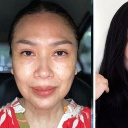 Mau Operasi Anti Aging seperti Titi DJ? Siapin Duit Segini