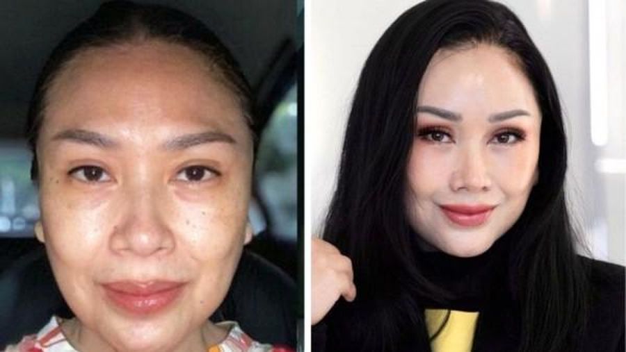 Penyanyi diva Indonesia Titi DJ baru-baru ini membagikan pengalamannya melakukan operasi anti aging atau anti penuaan di Gangnam, Korea Selatan pada 6 Januari lalu. (Tangkapan layar instagram @ti2dj)