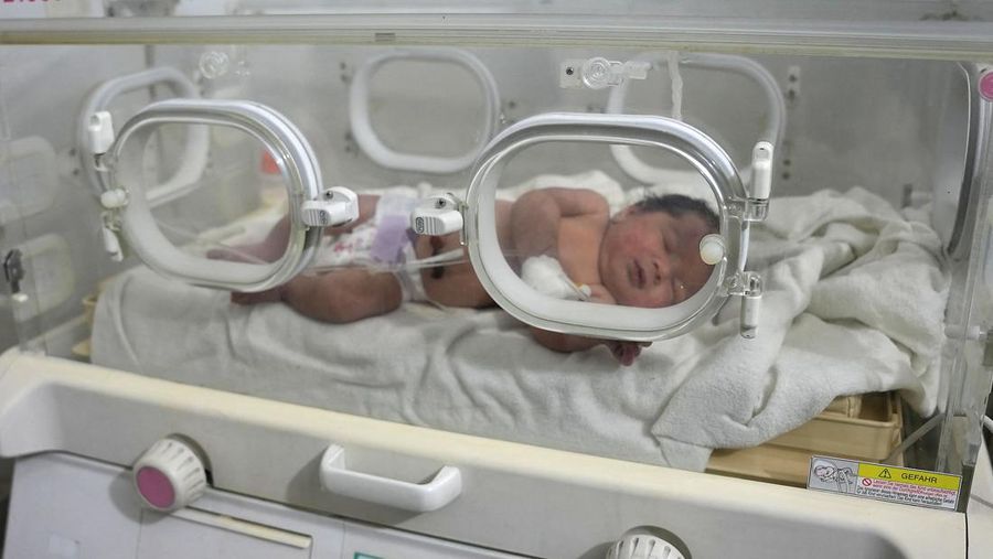 Bayi baru lahir yang ditemukan masih terikat tali pusar ke ibunya dan ditarik hidup-hidup dari puing-puing sebuah rumah di Suriah utara setelah gempa mematikan, menerima perawatan medis di sebuah klinik di Afrin, pada 7 Februari 2023. - Bayi tersebut adalah satu-satunya yang selamat dari keluarga terdekatnya, yang semuanya tewas ketika gempa berkekuatan 7,8 yang melanda Suriah dan negara tetangga Turki meratakan rumah keluarga di kota Jindayris yang dikuasai pemberontak, kata sepupu Khalil al-Suwadi. (RAMI AL SAYED/AFP via Getty Images)
