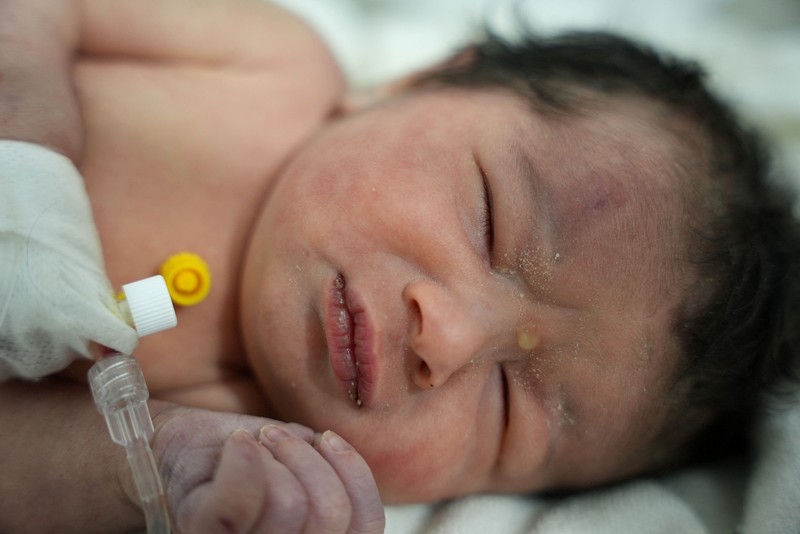 Bayi baru lahir yang ditemukan masih terikat tali pusar ke ibunya dan ditarik hidup-hidup dari puing-puing sebuah rumah di Suriah utara setelah gempa mematikan, menerima perawatan medis di sebuah klinik di Afrin, pada 7 Februari 2023. - Bayi tersebut adalah satu-satunya yang selamat dari keluarga terdekatnya, yang semuanya tewas ketika gempa berkekuatan 7,8 yang melanda Suriah dan negara tetangga Turki meratakan rumah keluarga di kota Jindayris yang dikuasai pemberontak, kata sepupu Khalil al-Suwadi. (RAMI AL SAYED/AFP via Getty Images)