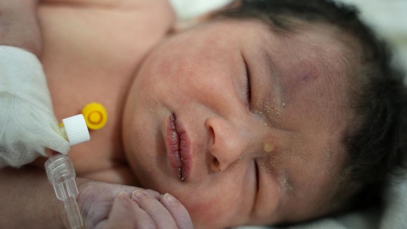 Bayi baru lahir yang ditemukan masih terikat tali pusar ke ibunya dan ditarik hidup-hidup dari puing-puing sebuah rumah di Suriah utara setelah gempa mematikan, menerima perawatan medis di sebuah klinik di Afrin, pada 7 Februari 2023. - Bayi tersebut adalah satu-satunya yang selamat dari keluarga terdekatnya, yang semuanya tewas ketika gempa berkekuatan 7,8 yang melanda Suriah dan negara tetangga Turki meratakan rumah keluarga di kota Jindayris yang dikuasai pemberontak, kata sepupu Khalil al-Suwadi. (RAMI AL SAYED/AFP via Getty Images)