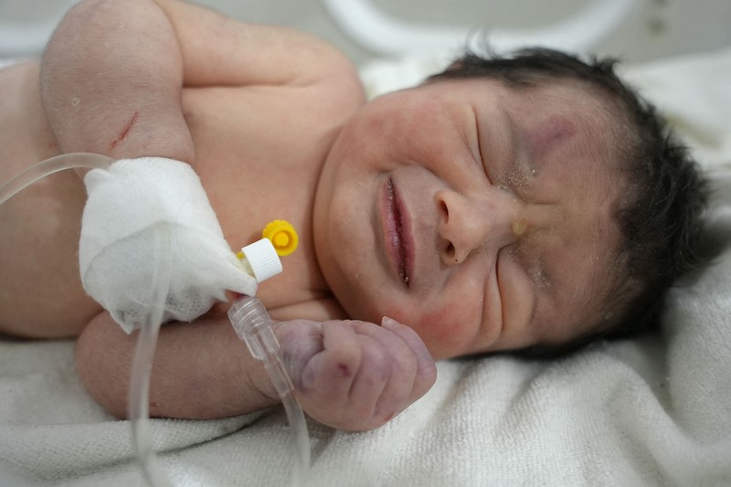 Bayi baru lahir yang ditemukan masih terikat tali pusar ke ibunya dan ditarik hidup-hidup dari puing-puing sebuah rumah di Suriah utara setelah gempa mematikan, menerima perawatan medis di sebuah klinik di Afrin, pada 7 Februari 2023. - Bayi tersebut adalah satu-satunya yang selamat dari keluarga terdekatnya, yang semuanya tewas ketika gempa berkekuatan 7,8 yang melanda Suriah dan negara tetangga Turki meratakan rumah keluarga di kota Jindayris yang dikuasai pemberontak, kata sepupu Khalil al-Suwadi. (RAMI AL SAYED/AFP via Getty Images)