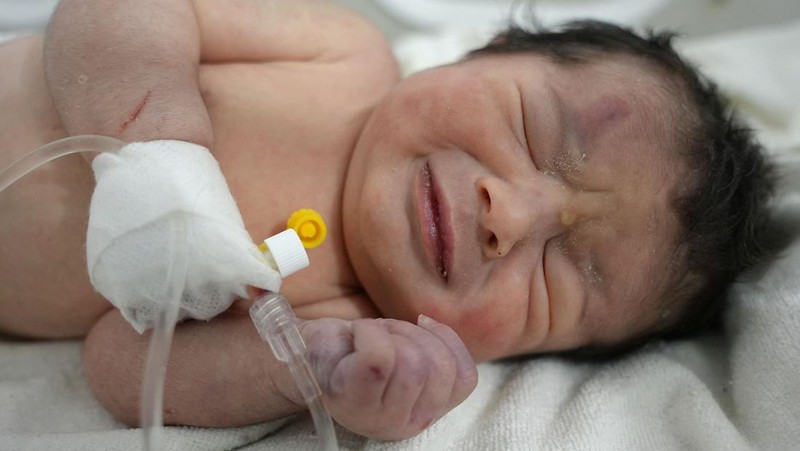 Bayi baru lahir yang ditemukan masih terikat tali pusar ke ibunya dan ditarik hidup-hidup dari puing-puing sebuah rumah di Suriah utara setelah gempa mematikan, menerima perawatan medis di sebuah klinik di Afrin, pada 7 Februari 2023. - Bayi tersebut adalah satu-satunya yang selamat dari keluarga terdekatnya, yang semuanya tewas ketika gempa berkekuatan 7,8 yang melanda Suriah dan negara tetangga Turki meratakan rumah keluarga di kota Jindayris yang dikuasai pemberontak, kata sepupu Khalil al-Suwadi. (RAMI AL SAYED/AFP via Getty Images)