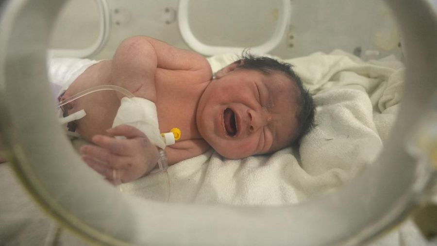 Seorang bayi baru lahir yang ditemukan masih terikat tali pusar ke ibunya dan ditarik hidup-hidup dari puing-puing sebuah rumah di Suriah utara setelah gempa mematikan, menerima perawatan medis di sebuah klinik di Afrin, pada 7 Februari 2023. - Bayi