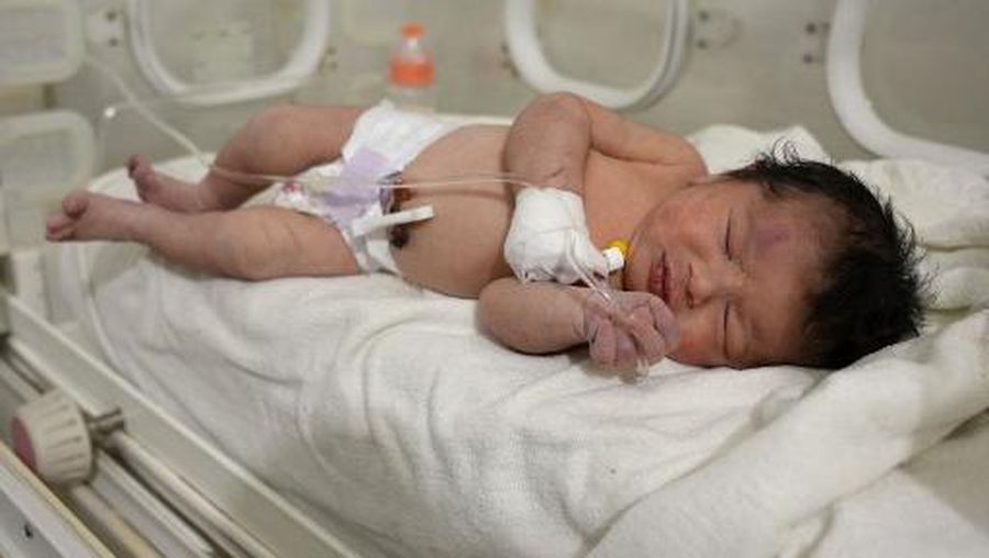 EDITORS NOTE: Graphic content / A newborn baby who was found still tied by her umbilical cord to her mother and pulled alive from the rubble of a home in northern Syria following a deadly earthquake, receives medical care at a clinic in Afrin, on February 7, 2023. - The infant is the sole survivor of her immediate family, the rest of whom were all killed when a 7.8-magnitude quake that struck Syria and neighbouring Turkey flattened the family home in the rebel-held town of Jindayris, cousin Khalil al-Suwadi said. (Photo by Rami al SAYED / AFP)