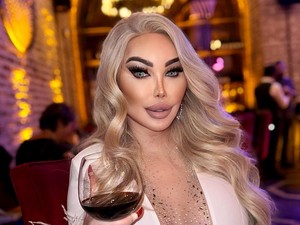 Transgender yang Oplas Lebih dari 100 Kali Kini Jalani Operasi Wajah Ke-5
