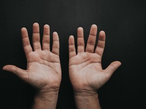 Kenapa Tangan Sering Berkeringat? Ini Penyebab dan Cara Mengatasinya
