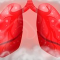 Bukan Cuma Rokok, Ini 5 Daftar Pemicu Kanker Paru-Paru Usia Muda