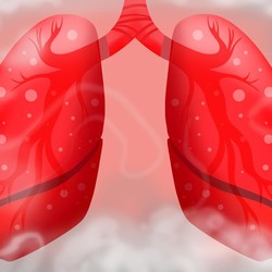 Bukan Cuma Rokok, Ini 5 Daftar Pemicu Kanker Paru-Paru Usia Muda