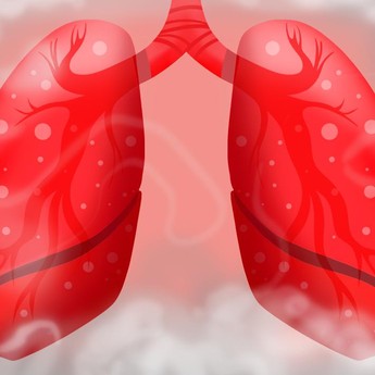 Perokok Wajib Baca, 5 Langkah Membersihkan Paru-Paru