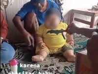 Jangan Dibiarkan, Bayi Obesitas Bisa Kena 5 Komplikasi Ini...