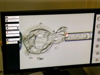 Rekor Dunia Pecah! Bayi Lahir dari Embrio yang Dibekukan 31 Tahun