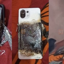 Kisah Tragis Anak 8 Tahun Tewas Kena HP Panas Meledak