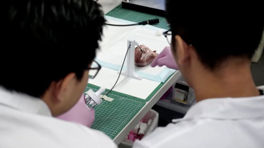 Sebuah tim insinyur biomedis di Australia telah mengembangkan robot fleksibel kecil untuk mencetak biomaterial 3D langsung di dalam tubuh manusia. (Tangkapan Layar VIdeo Reuters)