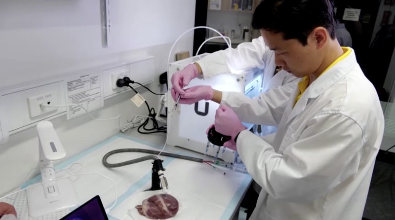 Sebuah tim insinyur biomedis di Australia telah mengembangkan robot fleksibel kecil untuk mencetak biomaterial 3D langsung di dalam tubuh manusia. Sebuah tim insinyur biomedis di Australia telah mengembangkan robot fleksibel kecil untuk mencetak biomaterial 3D langsung di dalam tubuh manusia. (Tangkapan Layar VIdeo Reuters)