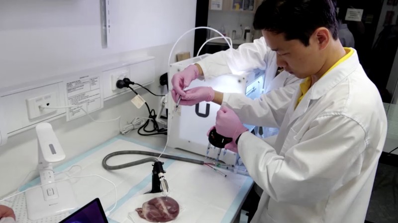 Sebuah tim insinyur biomedis di Australia telah mengembangkan robot fleksibel kecil untuk mencetak biomaterial 3D langsung di dalam tubuh manusia. (Tangkapan Layar VIdeo Reuters)