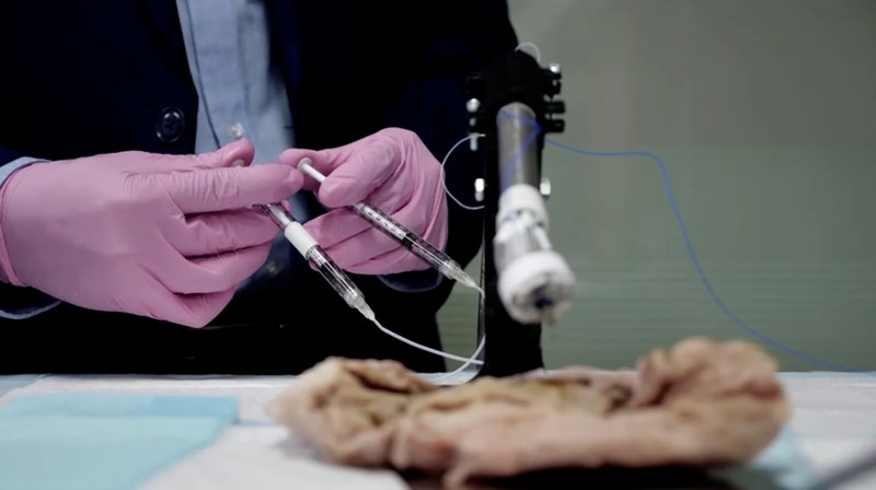 Sebuah tim insinyur biomedis di Australia telah mengembangkan robot fleksibel kecil untuk mencetak biomaterial 3D langsung di dalam tubuh manusia. Sebuah tim insinyur biomedis di Australia telah mengembangkan robot fleksibel kecil untuk mencetak biomaterial 3D langsung di dalam tubuh manusia. (Tangkapan Layar VIdeo Reuters)