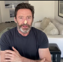 Hugh Jackman Ajak Penggemar Rajin Gunakan Sunscreen, Ada Apa?